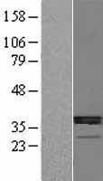NBL1-11719 - HSD11B1 Lysate